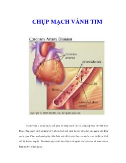 Chụp mạch vành tim