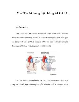 MSCT –64 trong hội chứng ALCAPA