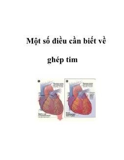 Một số điều cần biết về ghép tim