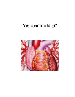 Viêm cơ tim là gì?