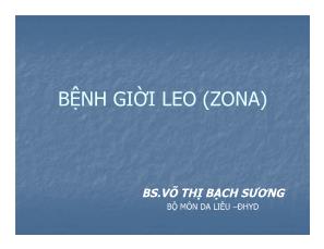 Bệnh giời leo (zona)