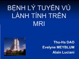 Bệnh lý tuyến vú lành tính trên mri