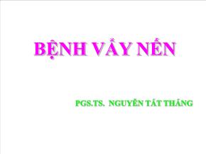 Bệnh vẩy nến