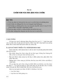 Châm cứu - Bài 12: Châm kim hoa mai (mai hoa châm)