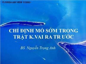 Chỉ định mổ sớm trong trật khớp vai ra trước