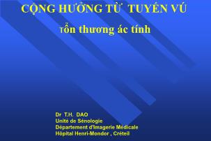 Cộng hưởng từ tuyến vú tổn thương ác tính