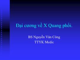 Đại cương về X Quang phổi