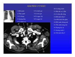 Giải phẫu CT ngực