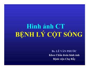 Hình ảnh CT bệnh lý cột sống