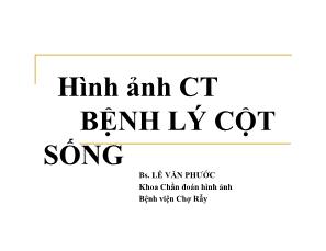 Hình ảnh CT bệnh lý cột sống