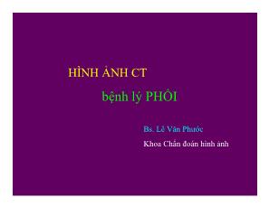 Hình ảnh CT bệnh lý phổi