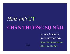 Hình ảnh CT chấn thương sọ não