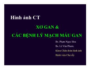 Hình ảnh CT xơ gan và các bệnh lý mạch máu gan