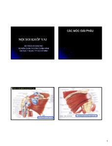 Nội soi khớp vai
