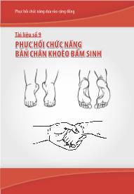 Phục hồi chức năng bàn chân khoèo bẩm sinh