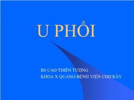 Tìm hiểu U phổi