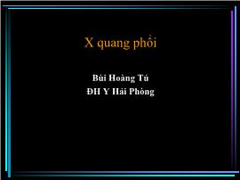 X quang phổi