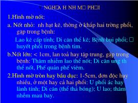 Ý nghĩa hình mờ phổi